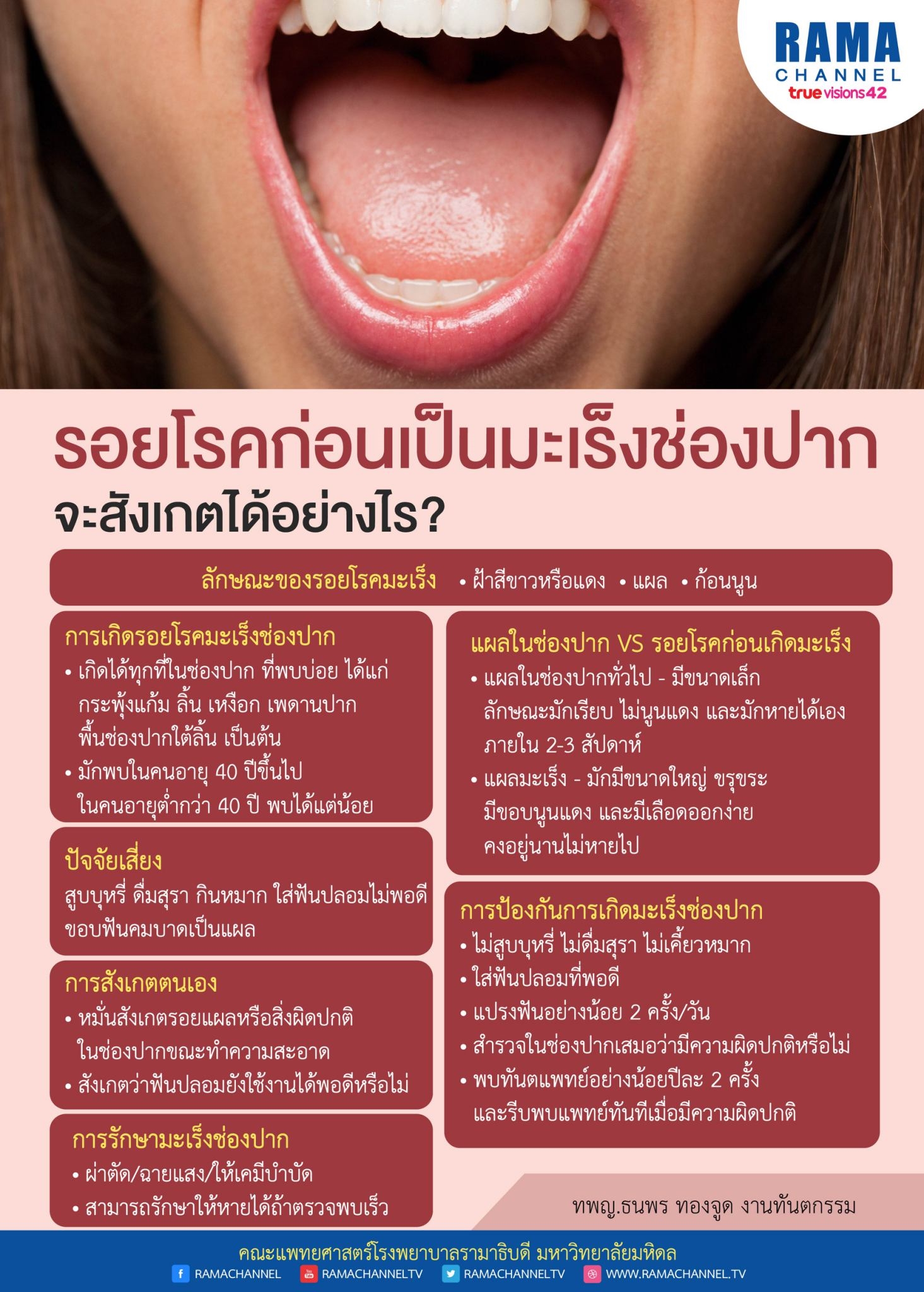 มะเร็งช่องปาก