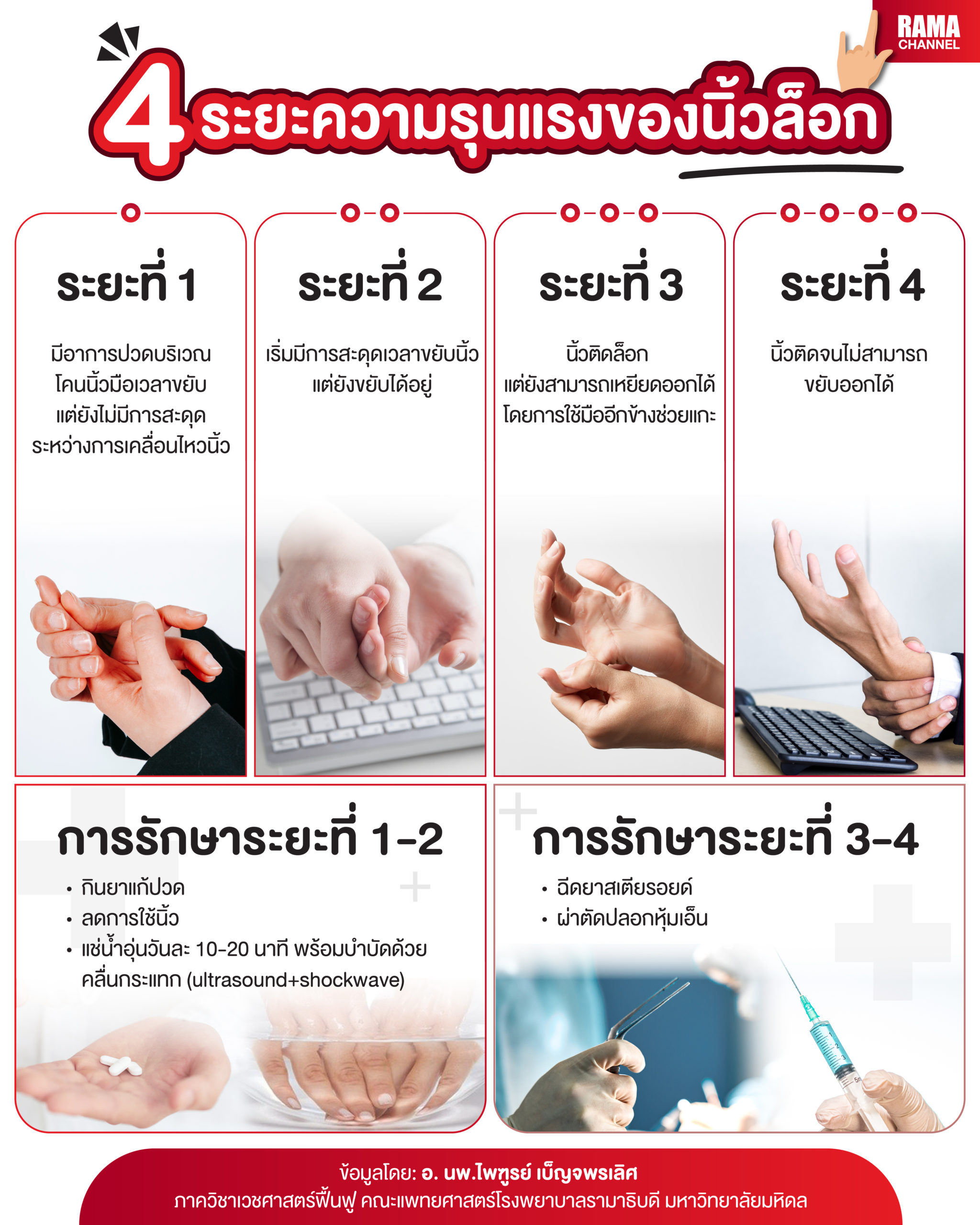 4 ระยะความรุนแรงของนิ้วล็อก-01
