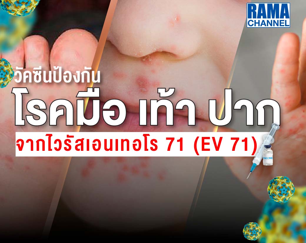 วัคซีนป้องกันโรคมือเท้าปาก EV71