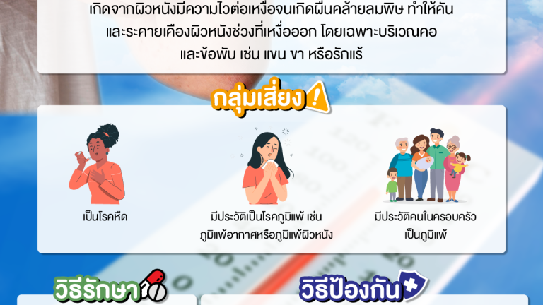 โรคผื่นแพ้เหงื่อ,ผื่นแพ้เหงื่อ,แพ้เหงื่อ,อากาศร้อน