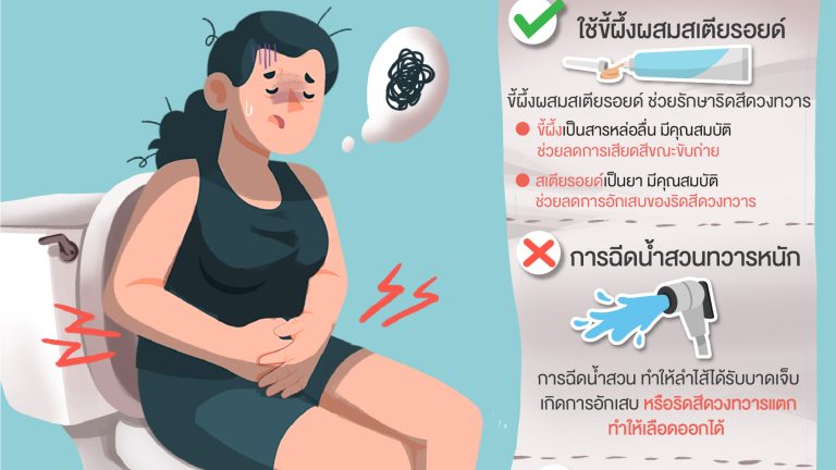 RAMA_info01_v5(ริดสีดวง)-01