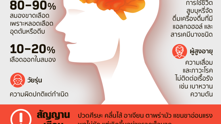 info หลอดเลือด