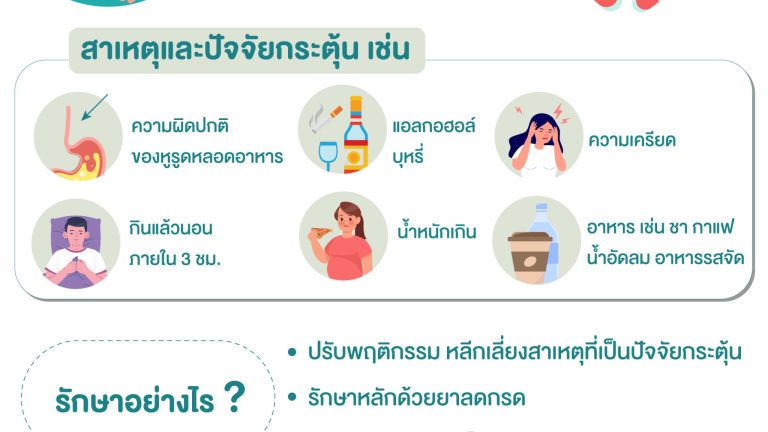 กรดไหลย้อน