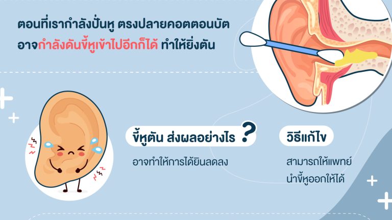 ขี้หูอุดตัน (1)