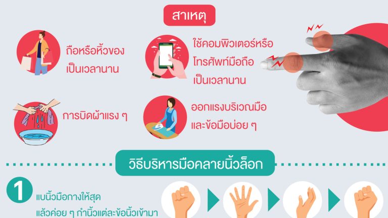 นิ้วล็อก 04-01