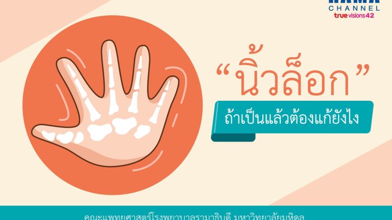 นิ้วล็อก1