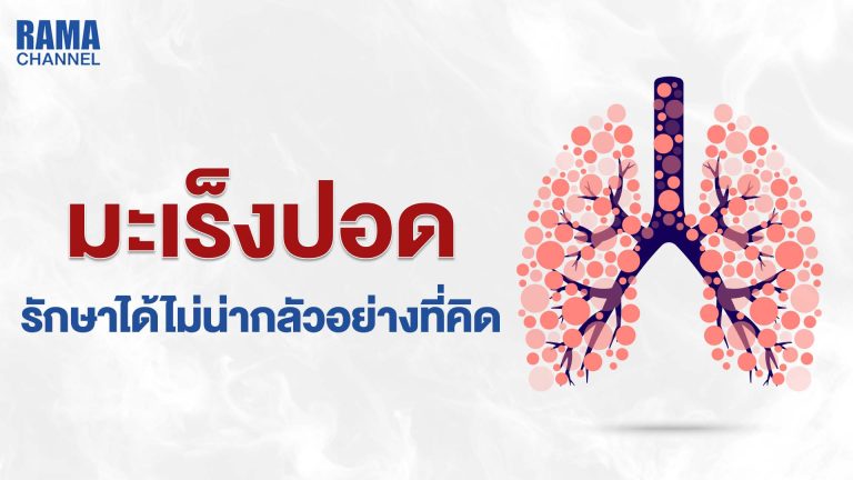 โรคมะเร็งปอด, วิธีการรักษา, สาเหตุมะเร็งปอด, อาการ