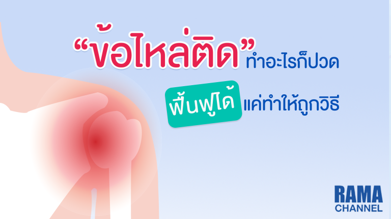 ข้อไหล่ติด, ฟื้นฟู, ท่ากายภาพ