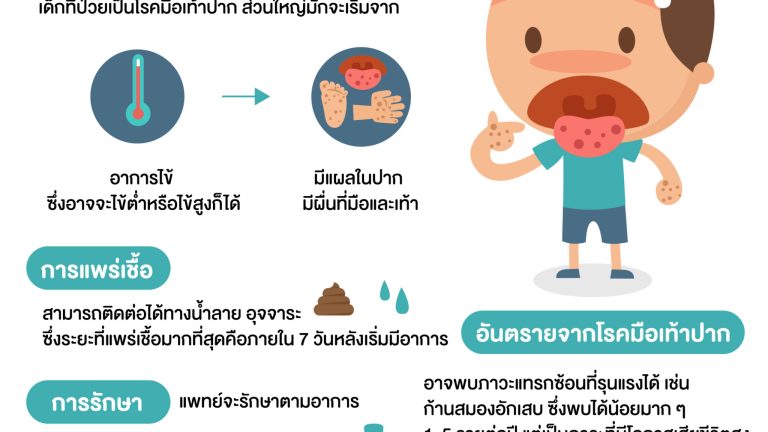 มือเท้าปาก