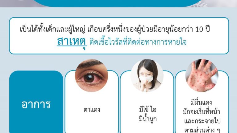 หัด
