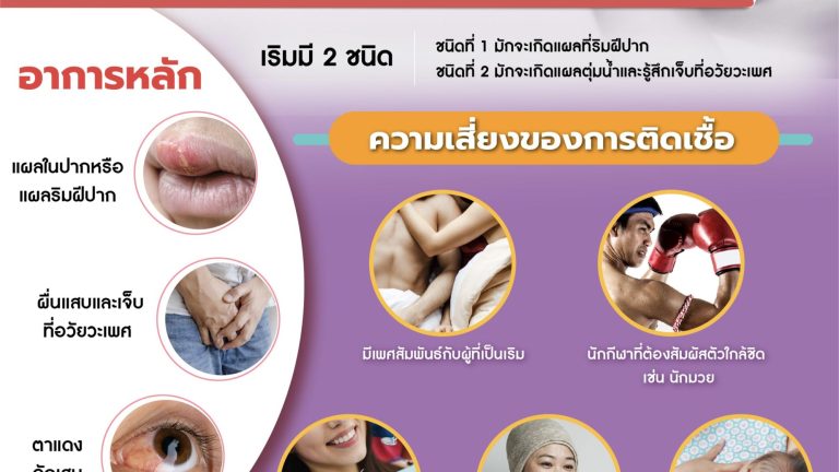 เริมติดกันได้ถ้าไม่ระวัง