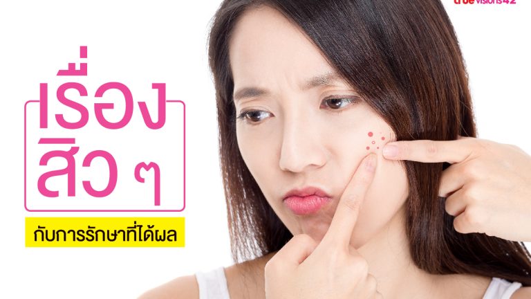เรื่องสิวๆกับการรักษาที่ได้ผล1