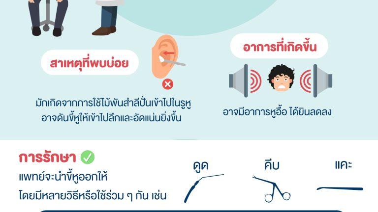 โครตขี้หู (1)