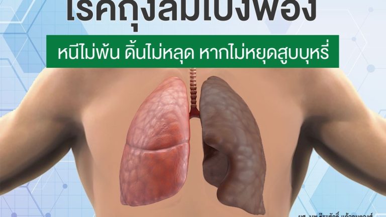 โรคถุงลมโป่งพอง1